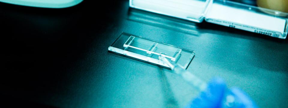 avian-metapneumovirus-diagnos-indonesia-1