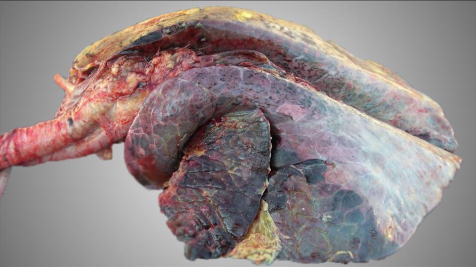 BVD Technique postmortem