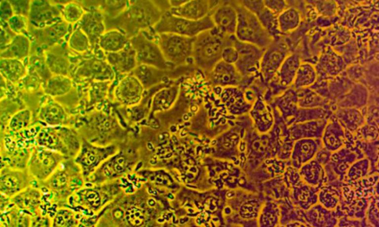thum-LEISHMANIA-diagnosis