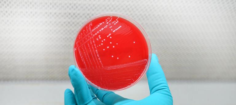 Mastitis pathogens detected in Europe using real-time multiplex PCR