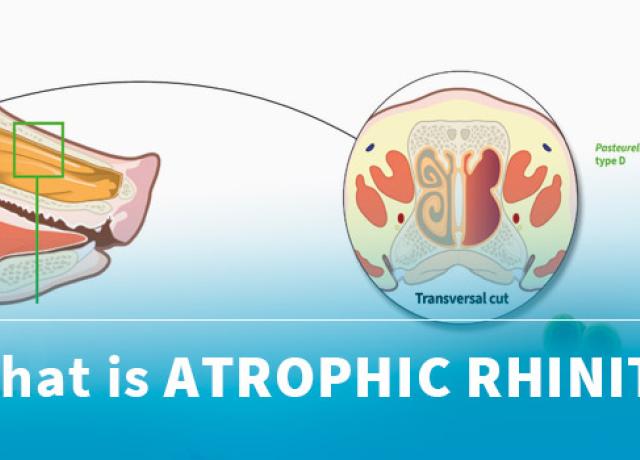 Banners-1stPage-RHINITIS-1B